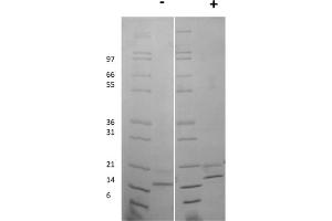 SDS-PAGE of Mouse Fibroblast Growth Factor-9 Recombinant Protein SDS-PAGE of Mouse Fibroblast Growth Factor-9 Recombinant Protein.