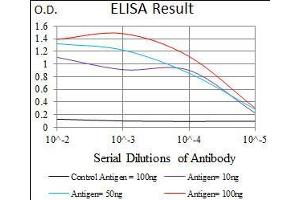 Black line: Control Antigen (100 ng), Purple line: Antigen(10 ng), Blue line: Antigen (50 ng), Red line: Antigen (100 ng), (SLC27A5 anticorps  (AA 508-570))