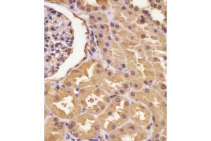 (ABIN390810 and ABIN2841047) staining ASS in human kidney tissue sections by Immunohistochemistry (IHC-P - paraformaldehyde-fixed, paraffin-embedded sections). (ASS1 anticorps  (AA 192-221))