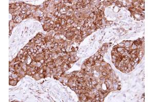 IHC-P Image Immunohistochemical analysis of paraffin-embedded human breast cancer, using FIG4, antibody at 1:500 dilution. (FIG4 anticorps  (Center))