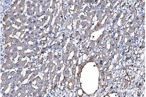 IHC analysis of GFPT1 using anti-GFPT1 antibody (ABIN7602887). (GFPT1 anticorps  (C-Term))