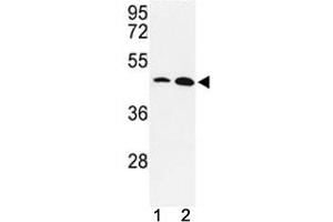 Western blot analysis of KLF4 antibody and MDA-MB231, NCI-H460 lysate. (KLF4 anticorps  (AA 481-504))