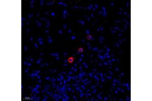 Immunofluorescence of paraffin embedded human colon using MADCAM1 (ABIN7074695) at dilution of 1:1800 (400x lens) (MADCAM1 anticorps)