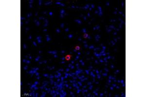 Immunofluorescence of paraffin embedded human colon using MADCAM1 (ABIN7074695) at dilution of 1:1800 (400x lens) (MADCAM1 anticorps)