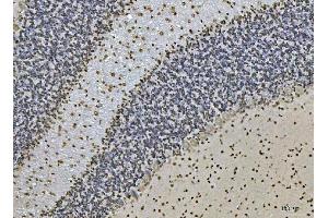 IHC analysis of Ataxin 1 using anti-Ataxin 1 antibody (ABIN7602773).