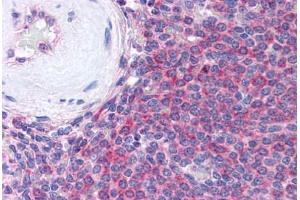 Human Spleen (formalin-fixed, paraffin-embedded) stained with THBS1 antibody ABIN305761 at 5 ug/ml followed by biotinylated anti-mouse IgG secondary antibody ABIN481714, alkaline phosphatase-streptavidin and chromogen. (Thrombospondin 1 anticorps)