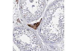 Immunohistochemical staining of human testis with SYNGAP1 polyclonal antibody  shows strong cytoplasmic positivity in Leydig cells. (SYNGAP1 anticorps)
