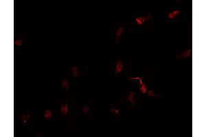 ABIN6269259 staining Hep G2 cells by IF/ICC. (GATA4 anticorps  (Internal Region))