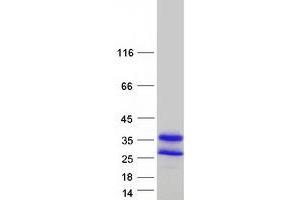 Validation with Western Blot