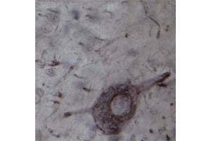 IHC on rat spinal cord (free floating sections) using Rabbit antibody to TRPC4  at a concentration of 20 µg/ml incubated overnight at room temperature with shake, developed with DAB/Ni. (TRPC4 anticorps)
