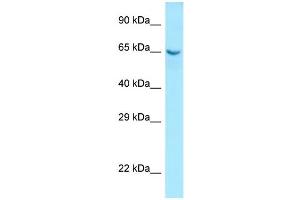 WB Suggested Anti-COL9A1 Antibody Titration: 1. (COL9A1 anticorps  (N-Term))