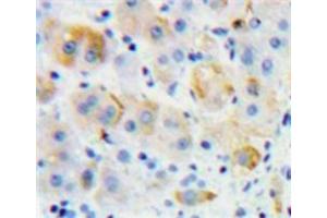 IHC-P analysis of Liver tissue, with DAB staining. (Growth Hormone Receptor anticorps  (AA 315-574))