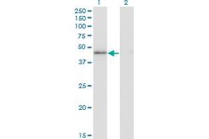 Western Blot analysis of HMG20A expression in transfected 293T cell line by HMG20A monoclonal antibody (M01), clone 4D5.
