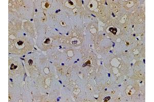 ABIN6267554 at 1/200 staining human heart tissue sections by IHC-P. (LIM Domain Kinase 1 anticorps  (pThr508))