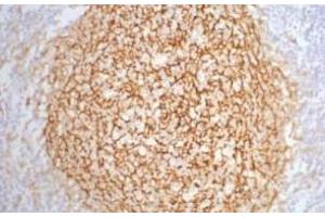 Immunohistochemistry of paraffin-embedded Human tonsil tissue using CD21 Monoclonal Antibody at dilution of 1:200. (CD21 anticorps)