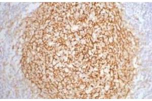 Immunohistochemistry of paraffin-embedded Human tonsil tissue using CD21 Monoclonal Antibody at dilution of 1:200. (CD21 anticorps)