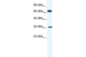 WB Suggested Anti-KCNN1 Antibody Titration:  1. (KCNN1 anticorps  (C-Term))
