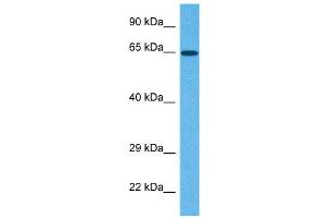 Host:  Rabbit  Target Name:  NOX1  Sample Tissue:  Human Jurkat Whole Cell  Antibody Dilution:  1ug/ml (NOX1 anticorps  (C-Term))