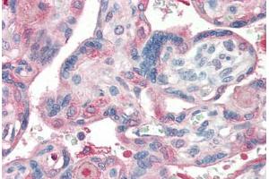 Human Placenta (formalin-fixed, paraffin-embedded) stained with Laminin antibody ABIN364494 at 5 ug/ml followed by biotinylated goat anti-rabbit IgG secondary antibody ABIN481713, alkaline phosphatase-streptavidin and chromogen. (Laminin anticorps)