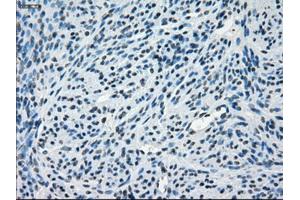 Immunohistochemical staining of paraffin-embedded endometrium tissue using anti-CRYABmouse monoclonal antibody. (CRYAB anticorps)