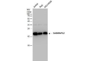 WB Image GABARAPL2 antibody detects GABARAPL2 protein by western blot analysis. (GABARAPL2 anticorps  (Center))