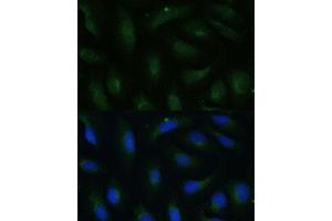 Immunofluorescence analysis of U-2 OS cells using COPG2 Polyclonal Antibody (ABIN7266426) at dilution of 1:100 (40x lens). (COPG2 anticorps  (AA 542-871))