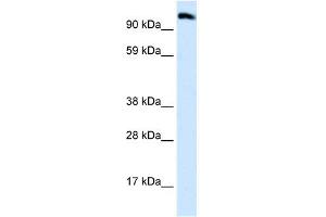 WB Suggested Anti-EEA1 Antibody Titration:  0. (EEA1 anticorps  (N-Term))