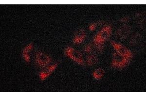 ABIN6274195 staining A549 cells by ICC/IF. (TNFRSF1B anticorps  (C-Term))