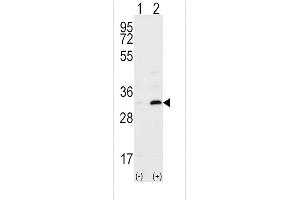 Western blot analysis of ST6 (arrow) using ST6 Antibody (C-term) (ABIN390184 and ABIN2840677).
