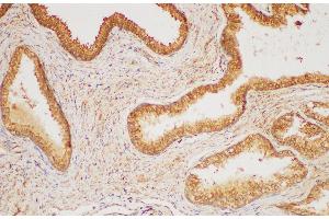 Immunohistochemistry of paraffin-embedded Human prostate gland using HRAS Polycloanl Antibody at dilution of 1:200 (HRAS anticorps)
