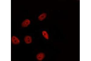 ABIN6277331 staining Hela by IF/ICC. (HSF2 anticorps  (Internal Region))