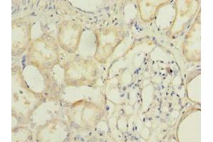 Immunohistochemistry of paraffin-embedded human kidney tissue using ABIN7173095 at dilution of 1:100 (TMEM174 anticorps  (AA 94-243))