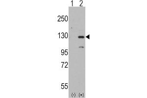 Western Blotting (WB) image for anti-Dishevelled Associated Activator of Morphogenesis 1 (DAAM1) antibody (ABIN3001578) (DAAM1 anticorps)