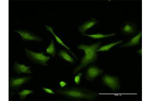 Immunofluorescence of monoclonal antibody to VDAC2 on HeLa cell.
