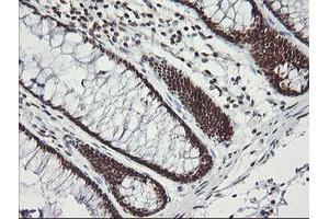 Immunohistochemical staining of paraffin-embedded Human colon tissue using anti-MCTS1 mouse monoclonal antibody. (MCTS1 anticorps  (AA 1-181))