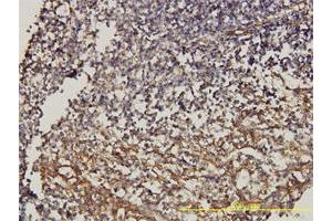 Immunoperoxidase of monoclonal antibody to CD58 on formalin-fixed paraffin-embedded human tonsil.