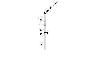 Anti-Hoxb1 Antibody (C-term) at 1:2000 dilution + human skeletal muscle lysates Lysates/proteins at 20 μg per lane.