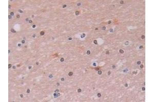 Detection of LOXL2 in Human Cerebrum Tissue using Polyclonal Antibody to Lysyl Oxidase Like Protein 2 (LOXL2)