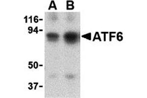Western Blotting (WB) image for anti-Activating Transcription Factor 6 (ATF6) (N-Term) antibody (ABIN1031243) (ATF6 anticorps  (N-Term))