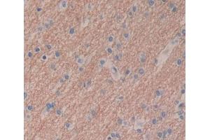 Used in DAB staining on fromalin fixed paraffin- embedded brain tissue (PTPN5 anticorps  (AA 331-558))