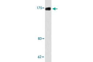 Western blot analysis of HT-29 cell lysate with TOP2A polyclonal antibody . (Topoisomerase II alpha anticorps)