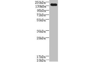 Western blot All lanes: UBE2O antibody at 0. (UBE2O anticorps  (AA 10-277))