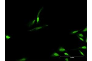 Immunofluorescence of purified MaxPab antibody to TIMELESS on HeLa cell. (TIMELESS anticorps  (AA 1-1208))