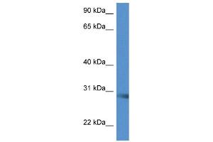 WB Suggested Anti-Scamp5 Antibody Titration: 1. (SCAMP5 anticorps  (C-Term))
