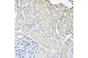 Immunohistochemistry of paraffin-embedded mouse kidney using MYLK antibody. (MYLK anticorps  (AA 1765-1914))