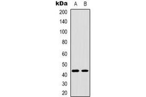Western blot analysis of TBX1 expression in Jurkat (A), COLO205 (B) whole cell lysates.