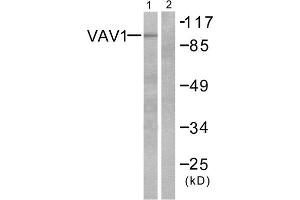 Western blot analysis of extracts from K562 cells, using VAV1 (epitope around residue 174) antibody (ABIN5976238, Line 1 and 2).
