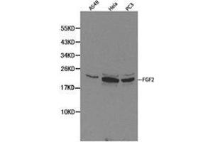 Western Blotting (WB) image for anti-Fibroblast Growth Factor 2 (Basic) (FGF2) antibody (ABIN1872685) (FGF2 anticorps)