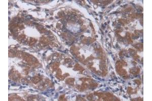 Detection of a2M in Human Stomach Tissue using Monoclonal Antibody to Alpha-2-Macroglobulin (a2M)