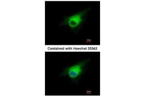 ICC/IF Image Immunofluorescence analysis of methanol-fixed A549, using PGD, antibody at 1:500 dilution. (PGD anticorps)
